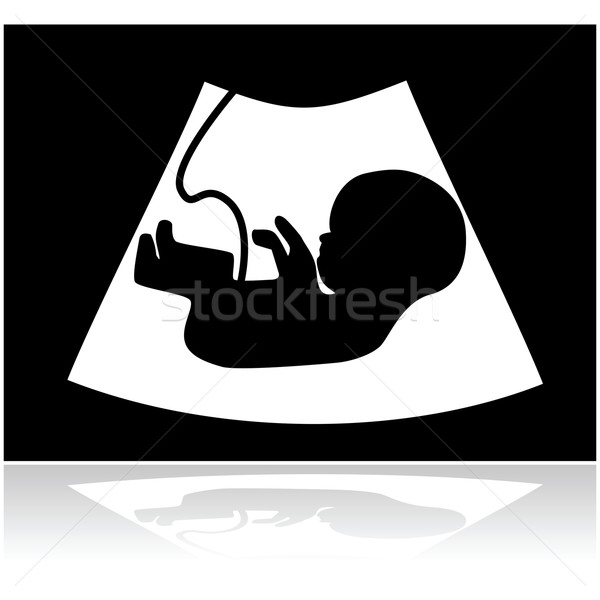 Ultraschall Illustration Baby innerhalb Mütter Stock foto © bruno1998