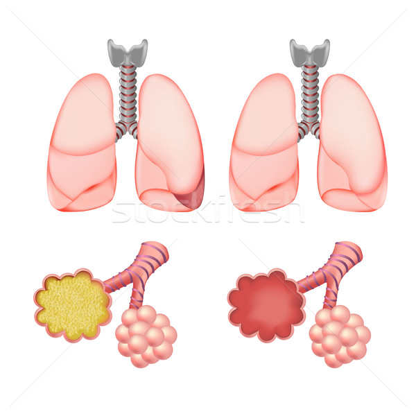 Stock photo: Alveoli In Lungs Set