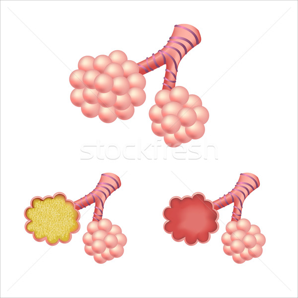 Stock photo: Alveoli In Set