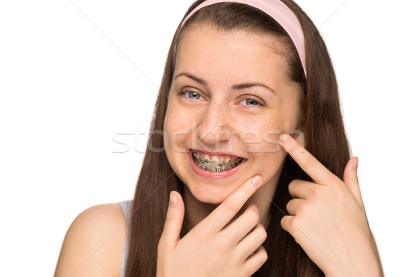 Smiling girl with braces squeezing pimple isolated Stock photo © CandyboxPhoto