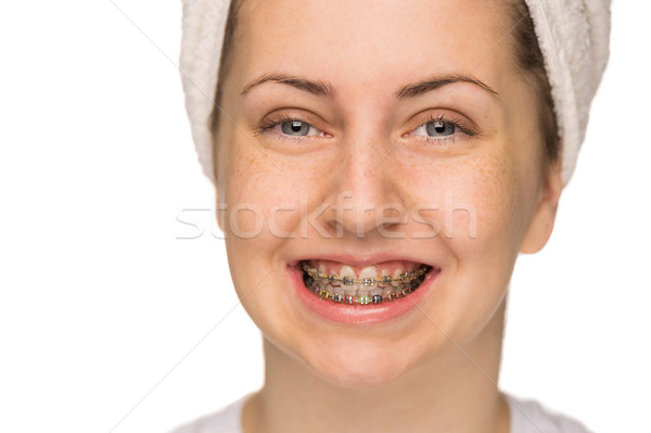 Cheerful girl with braces isolated Stock photo © CandyboxPhoto