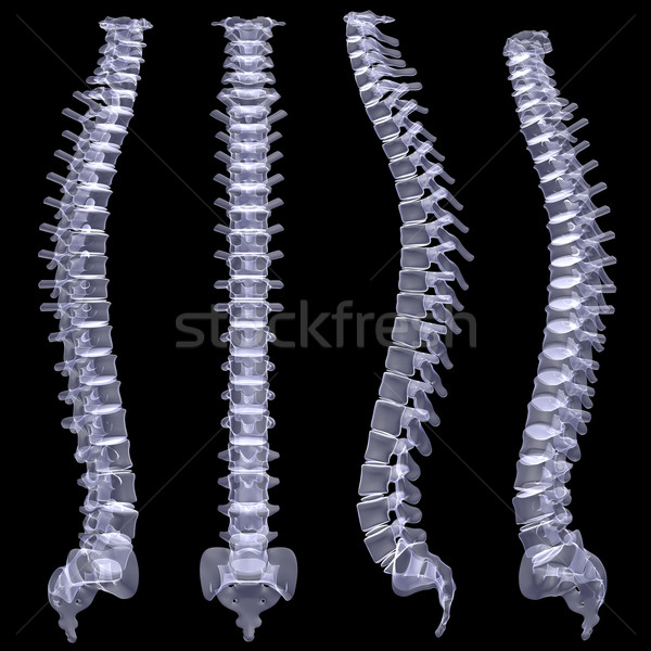 Emberi gerincoszlop röntgen render fekete orvos Stock fotó © cherezoff