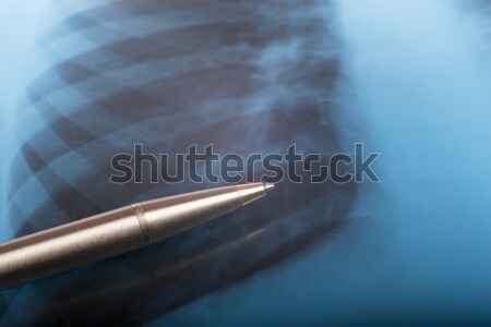 X-ray examination Stock photo © cherezoff