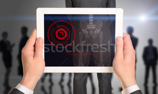 Businessman holding tablet with x-ray of mans back Stock photo © cherezoff