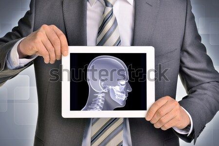 Man hands using tablet pc. Image of x-ray head on screen Stock photo © cherezoff