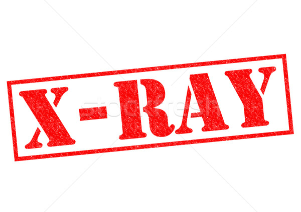 X-RAY Rubber Stamp Stock photo © chrisdorney