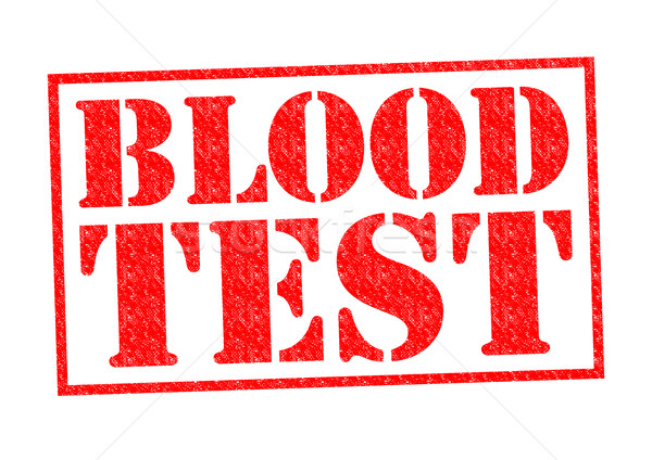 BLOOD TEST Stock photo © chrisdorney