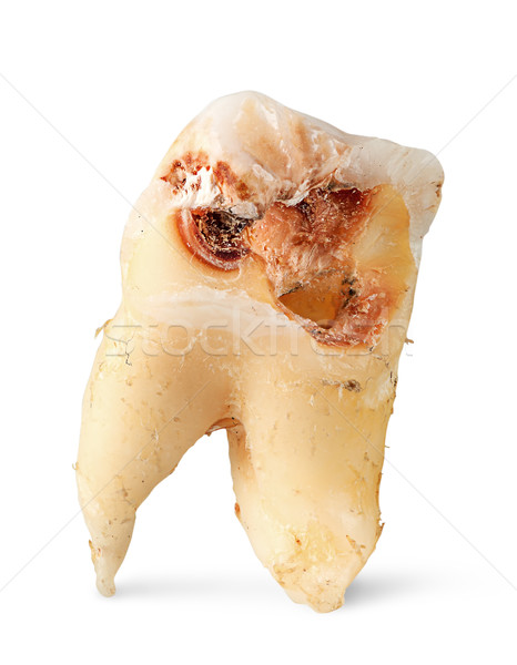 Closeup single tooth with caries vertically Stock photo © Cipariss