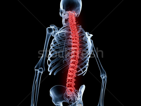 Foto stock: Dolor · de · espalda · espina · rojo · columna · humanos · esqueleto