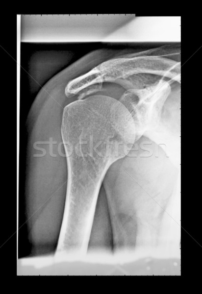 X射線 醫生 肩 使用 診斷 放射線學 商業照片 © claudiodivizia