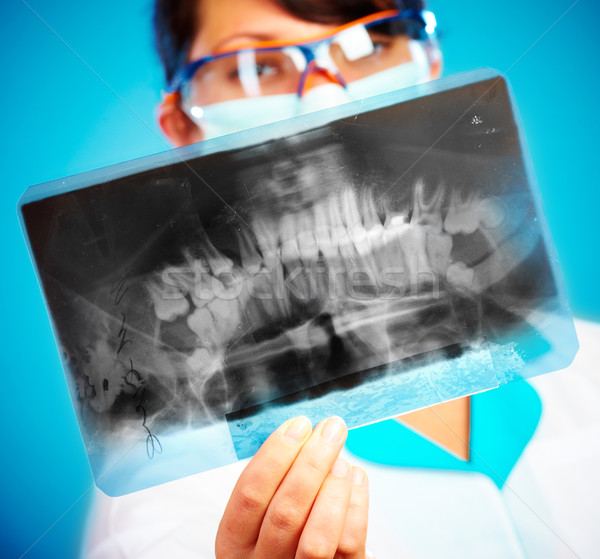 Orvos röntgen női állkapocs fókusz kéz Stock fotó © cookelma