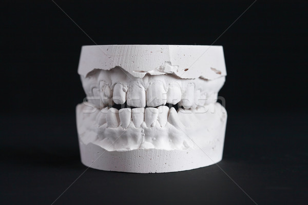 Dental muffa gesso nero salute medicina Foto d'archivio © cosma