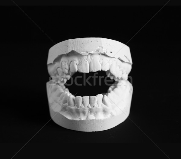 Dentar mucegai gips negru sănătate medicină Imagine de stoc © cosma