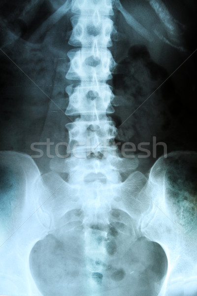 Xray wervelkolom vrouw medische film gezondheid Stockfoto © cozyta