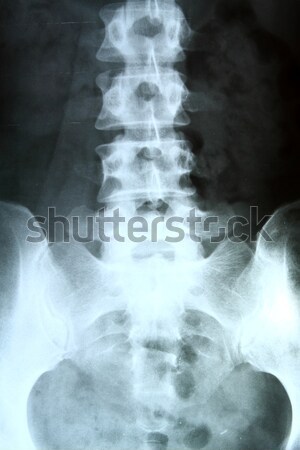 X射線 脊柱 女子 醫生 電影 健康 商業照片 © cozyta