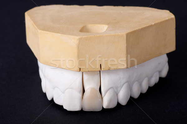 detail dental wax model Stock photo © csakisti