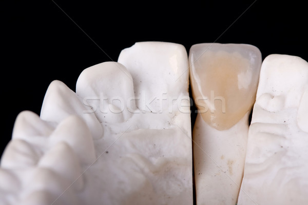 Stock photo: detail dental wax model