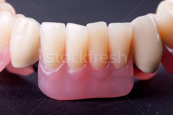 detail dental wax model Stock photo © csakisti