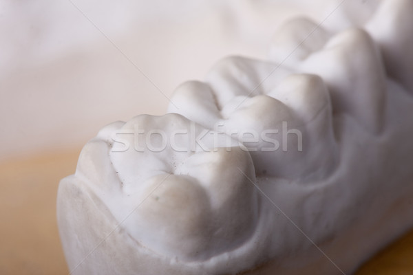 Detay diş balmumu model tıbbi köprü Stok fotoğraf © csakisti