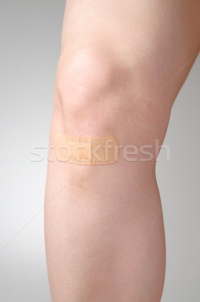 Gips weiblichen Bein Klebstoff Verband jungen Stock foto © CsDeli