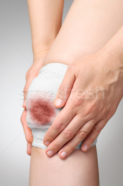 Sebesült térd véres bandázs fájdalmas fehér Stock fotó © CsDeli