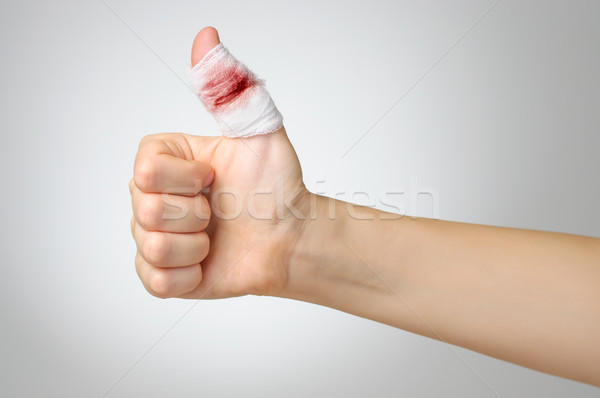 Sebesült ujj véres bandázs nő kéz Stock fotó © CsDeli