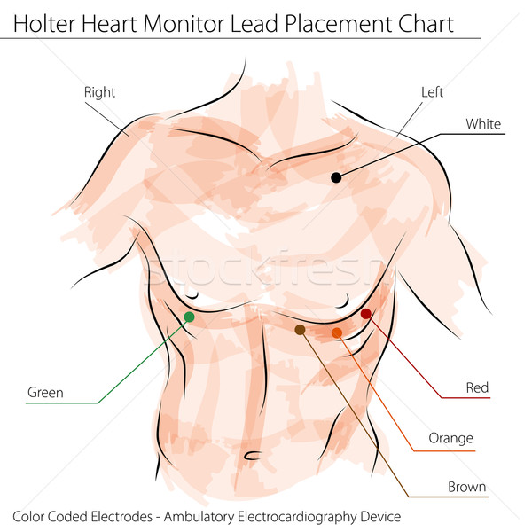 Szív monitor elhelyezés diagram kép orvosi Stock fotó © cteconsulting