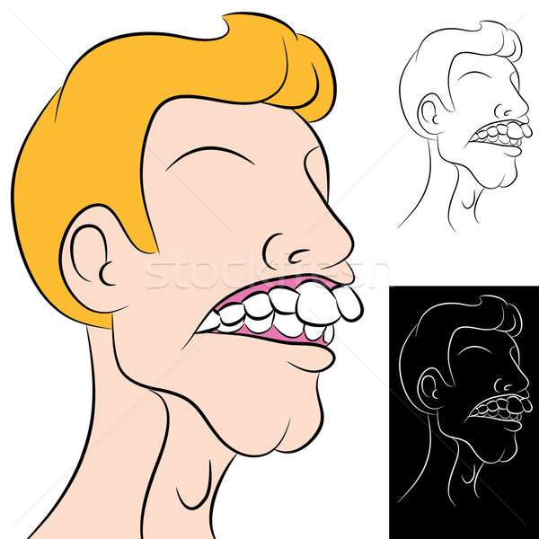 Man With Overbite Stock photo © cteconsulting