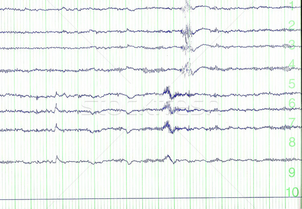 Puls wyszukiwania serca śmierci nauki Zdjęcia stock © cynoclub