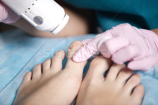 Woman receiving laser treatment on her feet Stock photo © d13