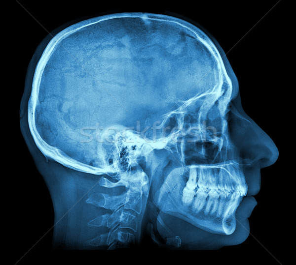 Human skull X-ray image Stock photo © daboost