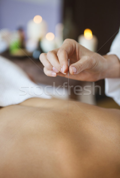Main acupuncture aiguille Retour femme Photo stock © dashapetrenko