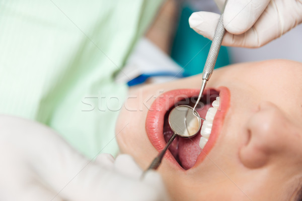 Közelkép beteg nyitva száj orális vizsgálat Stock fotó © deandrobot