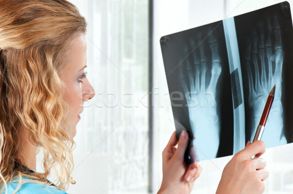 Doctor with x-ray Stock photo © DenisNata