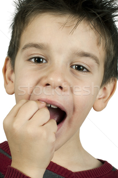 Little boy shows a broken tooth Stock photo © deyangeorgiev