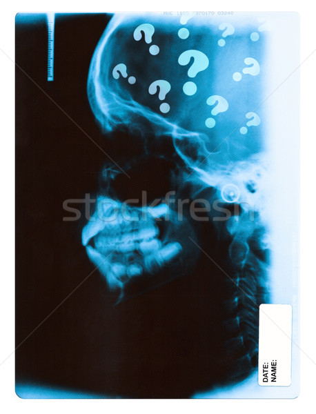 Xray preguntas imagen nino cráneo completo Foto stock © Dinga