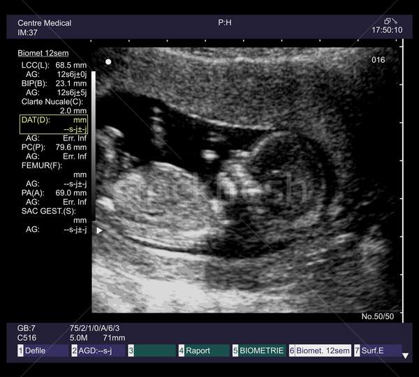 Ultraschall Fötus 12 Baby medizinischen Kind Stock foto © dip