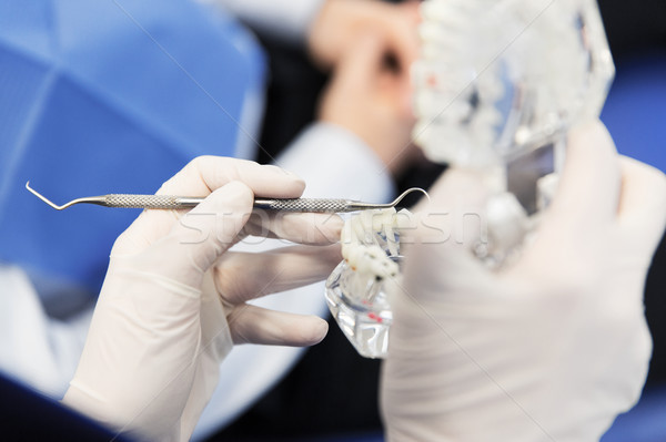 close up of dentist with teeth and dental probe Stock photo © dolgachov