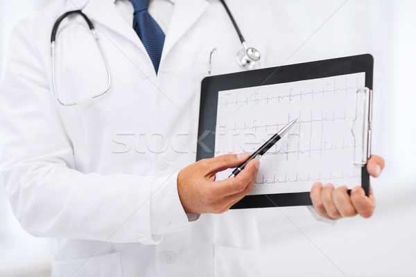 Männlichen Arzt Hände halten EKG Gesundheitswesen medizinischen Stock foto © dolgachov