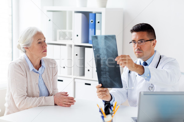 Altos mujer médico Xray hospital medicina Foto stock © dolgachov