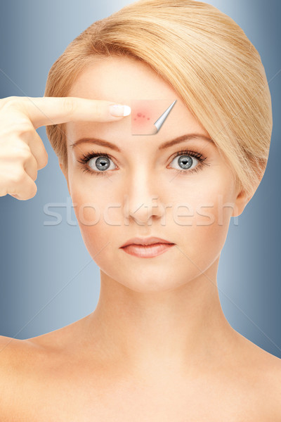 Geen meer acne foto mooie vrouw wijzend Stockfoto © dolgachov