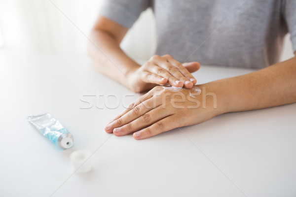 close up of hands with cream or therapeutic salve Stock photo © dolgachov