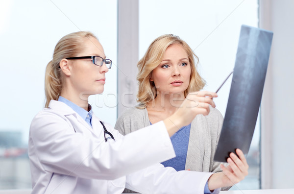 Nő beteg orvos gerincoszlop röntgen scan Stock fotó © dolgachov