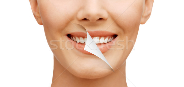 Fogfehérítés szépség fogászati egészség gyönyörű nő fehér fogak Stock fotó © dolgachov