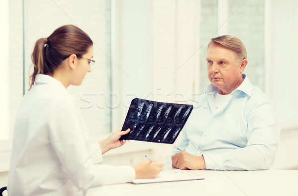 Női orvos idős férfi néz röntgen egészségügy Stock fotó © dolgachov