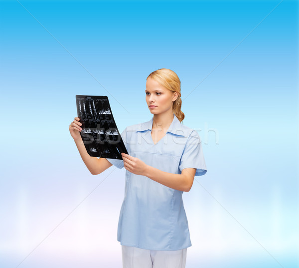 Foto stock: Grave · médico · enfermera · mirando · Xray · salud