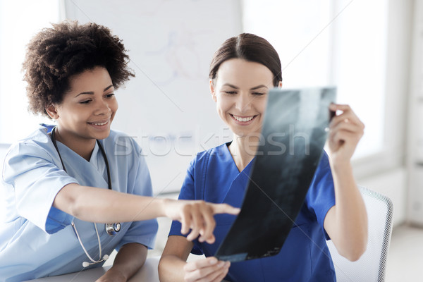 Stock photo: happy female doctors with x-ray image at hospital