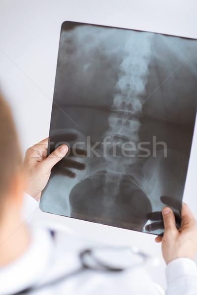 Orvos tart röntgen kép közelkép férfi orvos Stock fotó © dolgachov