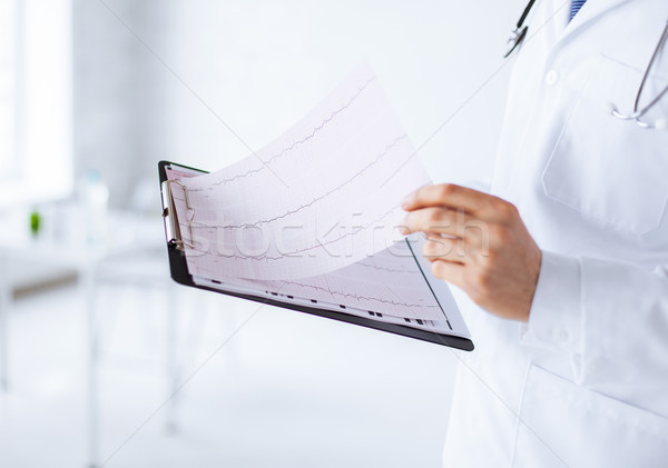 Férfi orvos kezek tart kardiogram fényes kép Stock fotó © dolgachov