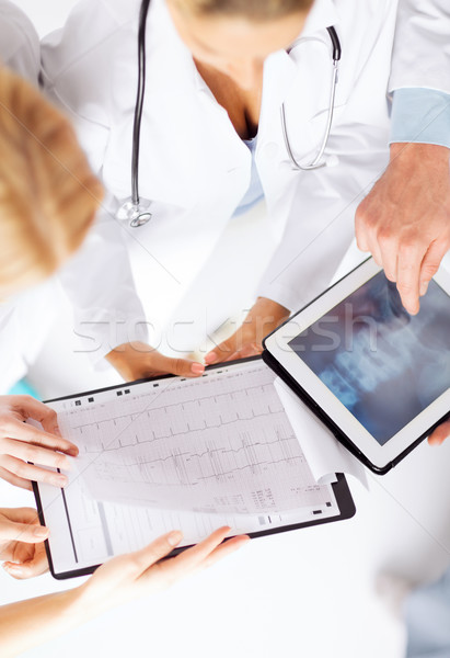 [[stock_photo]]: Groupe · médecins · regarder · xray · santé